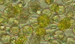 Foto microscop electronic, exina lizata studiu Melidava